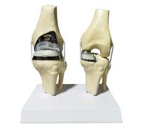 LKYLVEE Modello di Protesi articolare del Ginocchio con cartilagine Artificiale Modello di Protesi per Chirurgo Ortopedico clinico Modello di Comunicazione con Il paziente,Bianca,20cm