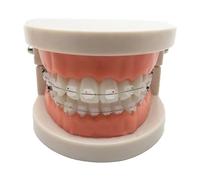LKYLVEE Modello dimostrativo ortodontico Dentale - Modello di Denti Standard - Modello di Trattamento con Staffa Metallica, Filo ad Arco Che spiega Il Modello con apparecchi ortodontici,G,8cm