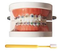 LKYLVEE Modello Dimostrativo Ortodontico Dentale Modello di Trattamento dei Denti Standard con Apparecchio Metallico, Filo dell'Arco Modello Esplicativo con Apparecchi, con Spazzolino