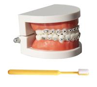 LKYLVEE Modello Dimostrativo Ortodontico Dentale Modello di Trattamento dei Denti Standard con Apparecchio Metallico, Filo dell'Arco Modello Esplicativo con Apparecchi, con Spazzolino