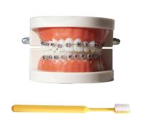 LKYLVEE Modello Dimostrativo Ortodontico Dentale Modello di Trattamento dei Denti Standard con Apparecchio Metallico, Filo dell'Arco Modello Esplicativo con Apparecchi, con Spazzolino