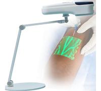 Localizzatore di vene multifunzionale, localizzatore di vene mediche portatile con batteria a lunga durata, supporta varie tonalità e condizioni della pelle, per infermieri, prelievi Tabletop