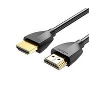 LOKLNEYK Cavo Splitter Audio 4K 3D HD 2.0, Compatibile Con Vention, Compatibile, Funziona Con PS4/3/proiettore/HDTV/X-box(Aluminum Alloy,1.5m)