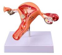 Lpitoy Modello Umano di Utero E Ovaio Femminile, Organo Genitale Femminile, Modello di Organo Riproduttivo, Modello di Insegnamento Medico Uterino Ginecologia Anatomica Utero Ovaio