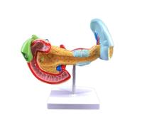 LSOAARRT Modello patologico anatomico del sistema digestivo del pancreas con la milza e il duodeno per la dimostrazione dell'istruzione