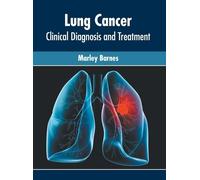 Lung Cancer: Clinical Diagnosis and Treatment (Copertina rigida)