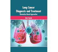 Lung Cancer Diagnosis and Treatment: Biomarker-based Approaches