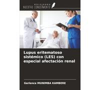 Lupus eritematoso sistémico (LES) con especial afectación renal