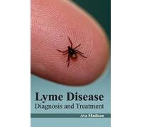 Lyme Disease: Diagnosis and Treatment (Copertina rigida)