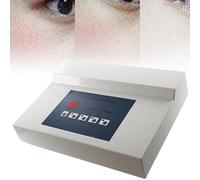 Macchina di bellezza per la rimozione delle vene facciali, dispositivo professionale per il trattamento delle macchie dei vasi sanguigni rossi e dei problemi vascolari