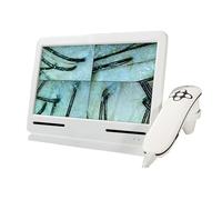 Macchina per l'analisi dei capelli e della pelle, analisi diagnostica del cuoio capelluto con due lenti 50x 200x, ingrandimento dell'umidità dell'olio follicolare