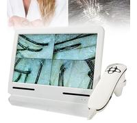Macchina per l'analisi del Cuoio capelluto Analizzatore di capelli e capelli per diagnosi della pelle, analizzatore di follicoli, microscopio digitale LCD con lente 200x, scanner per ricaric