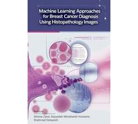 Machine Learning Approaches for Breast Cancer Diagnosis Using Histopathology Images