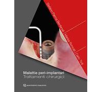 Malattie peri-implantari. Trattamenti chirurgici