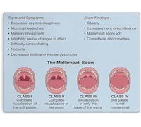 Mallampati Classification Airway Assessment Poster Clinical Reference Wall Art for Clinic Education Medical Students