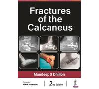 Mandeep S Dhillon Fractures of the Calcaneus (Copertina rigida)