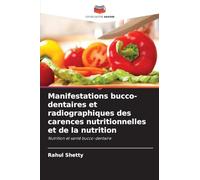 Manifestations bucco-dentaires et radiographiques des carences nutritionnelles et de la nutrition: Nutrition et santé bucco-dentaire