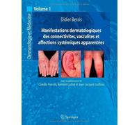 Manifestations Dermatologiques des Connectivites, Vasculites et Affections Systemiques Apparentees. de J -J Guilhou (3 août 2010) Broché