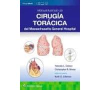 Manual ilustrado de Cirugía torácica del Massachusetts General Hospital