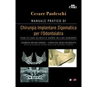 Manuale pratico di Chirurgia Implantare Zigomatica per l’Odontoiatra. (Versione IT-ENG)