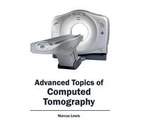 Marcus Lewis Advanced Topics of Computed Tomography (Copertina rigida)