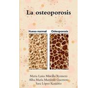 Maria Luisa Morillo Romero Alba María Martínez Guerr La osteoporosis (Tascabile)
