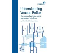 Mark S. Whitele Understanding Venous Reflux the Cause of Varicose Ve (Tascabile)
