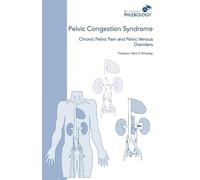 Mark S Whiteley Pelvic Congestion Syndrome - Chronic Pelvic Pain and (Tascabile)