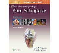 Mark W. Pagnano Master Techniques in Orthopedic Surgery: Knee (Copertina rigida)