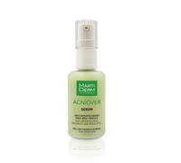 Martiderm - Acniover - Serum - 30 ml