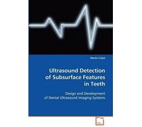 Martin Culjat Ultrasound Detection of Subsurface Features in Teeth (Tascabile)
