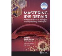 Mastering Iris Repair: A Video Textbook of Iris Repair and Pupilloplasty Techniques