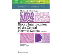 Matthew J. Schni Biopsy Interpretation of the Central Nervous (Copertina rigida)