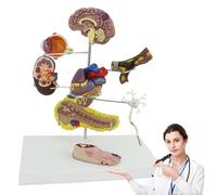 Mavdecll Modello di Patologia Diabetica Umana, Set di Modelli di Diabete con 8 Componenti, Modello di Trombosi del Piede, Cervello, Cuore, Rene, Visualizzazione del Diabete E delle Complicazioni