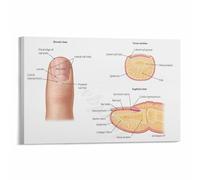 MDBJTCYZN Human Nail Anatomy Poster Structure Chart Educational Wall-Art for Dermatology Podiatry Clinic Office Classroom Decor(Framed,08x12inch(20x30cm))