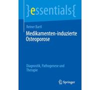 Medikamenten-induzierte Osteoporose: Diagnostik, Pathogenese und Therapie