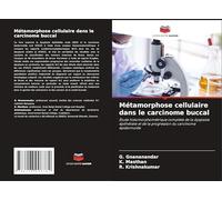 Métamorphose cellulaire dans le carcinome buccal: Étude histomorphométrique complète de la dysplasie épithéliale et de la progression du carcinome épidermoïde