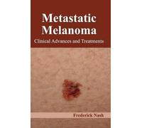 Metastatic Melanoma: Clinical Advances and Treatments (Copertina rigida)