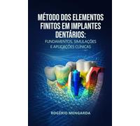 MÉTODO DOS ELEMENTOS FINITOS EM IMPLANTES DENTÁRIOS: FUNDAMENTOS, SIMULAÇÕES E APLICAÇÕES CLÍNICASMÉTODO DOS ELEMENTOS FINITOS EM IMPLANTES DENTÁRIOS