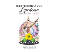 MI EXPERIENCIA CON LIPEDEMA: Dieta - Ejercicio - Cirugías