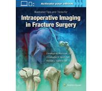 Michael J. Gard Illustrated Tips and Tricks for Intraoperativ (Copertina rigida)