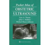 Michael Manco-Johnson John C. Hobbins Gar Pocket Atlas of Obstetric (Tascabile)