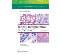 Michael Torbenson Biopsy Interpretation of the Liver (Copertina rigida)
