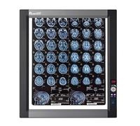 MIDUOLAI Lampada per La Visione di Raggi X, con Luminosità Regolabile, Manopola Dimmerabile, Pannello in Acrilico E Telaio in Alluminio, per Uso Domestico E in Laboratorio,Single