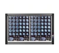 MIDUOLAI Lampada per La Visione di Raggi X, con Luminosità Regolabile, Manopola Dimmerabile, Pannello in Acrilico E Telaio in Alluminio, per Uso Domestico E in Laboratorio,Double