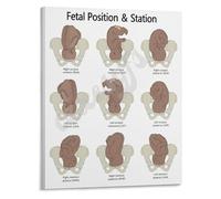 Midwife Reference Poster Fetal Positioning and Birth Progress Chart Canvas Wall Art for Birthing Suite Decor(Framed,16x24inch(40x60cm))