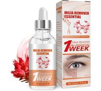 Milia Siero per rimuovere gli occhi - Siero viso contro milie e macchie scure, contro le borse per gli uomini e le donne, riduce la pelle flaccida, gonfiore e linee sottili, 30 ml (1PCS)