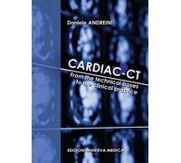 Minerva Cardiac-CT. From the technical bases to the clinical practice
