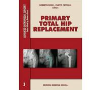 Minerva Primary total hip replacement [Lingua inglese]: 3