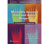 Minimally Invasive Foot and Ankle Surgery: A Percutaneous Approach